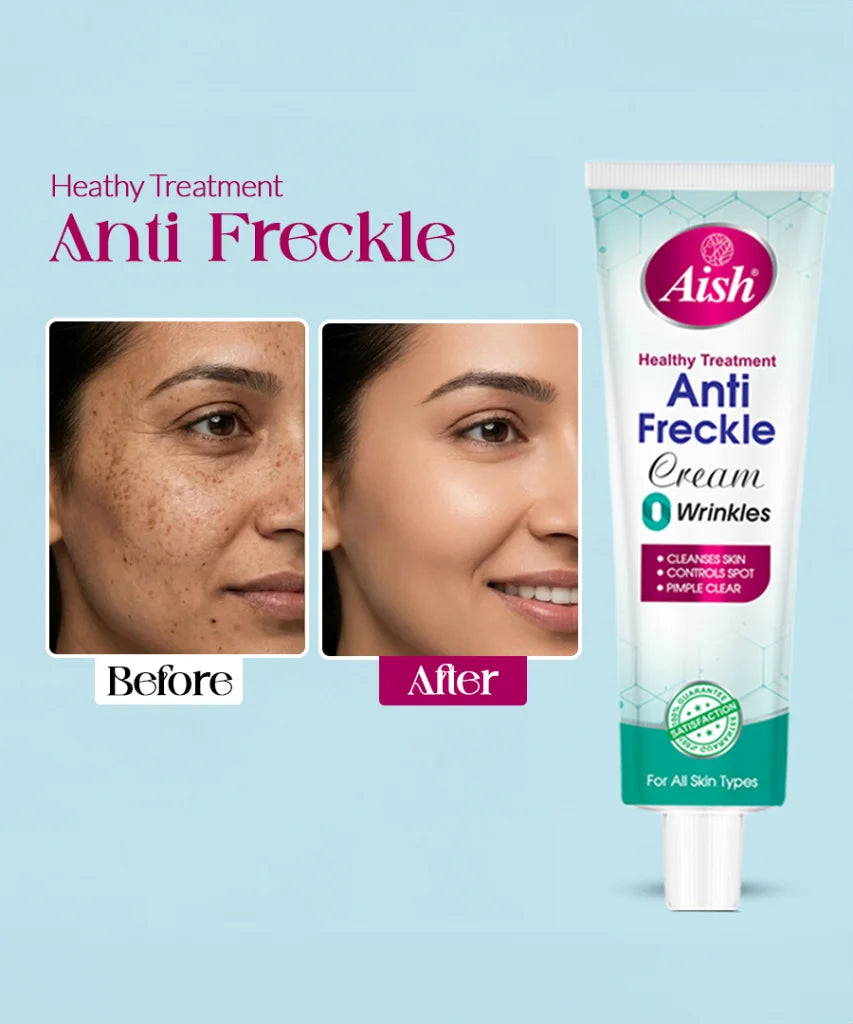 AISH ANTI FRECKLE CREAM 20GRM