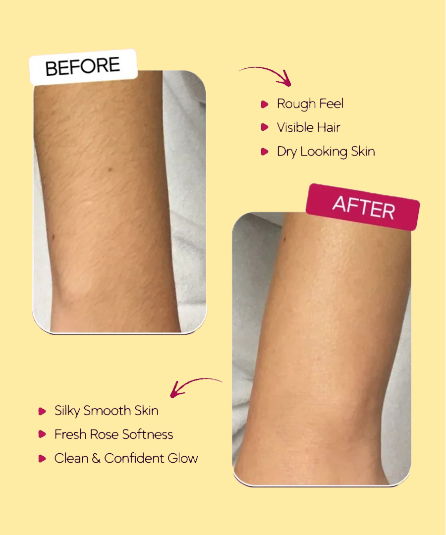 AISH PREMIUM YELLOW HAIR REMOVAL HRC TUBE | SMOOTH & SILKY SKIN
